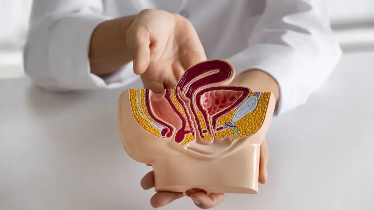Model anatomiczny przedstawia narządy miednicy mniejszej, gdzie widoczny jest polip cewki moczowej.