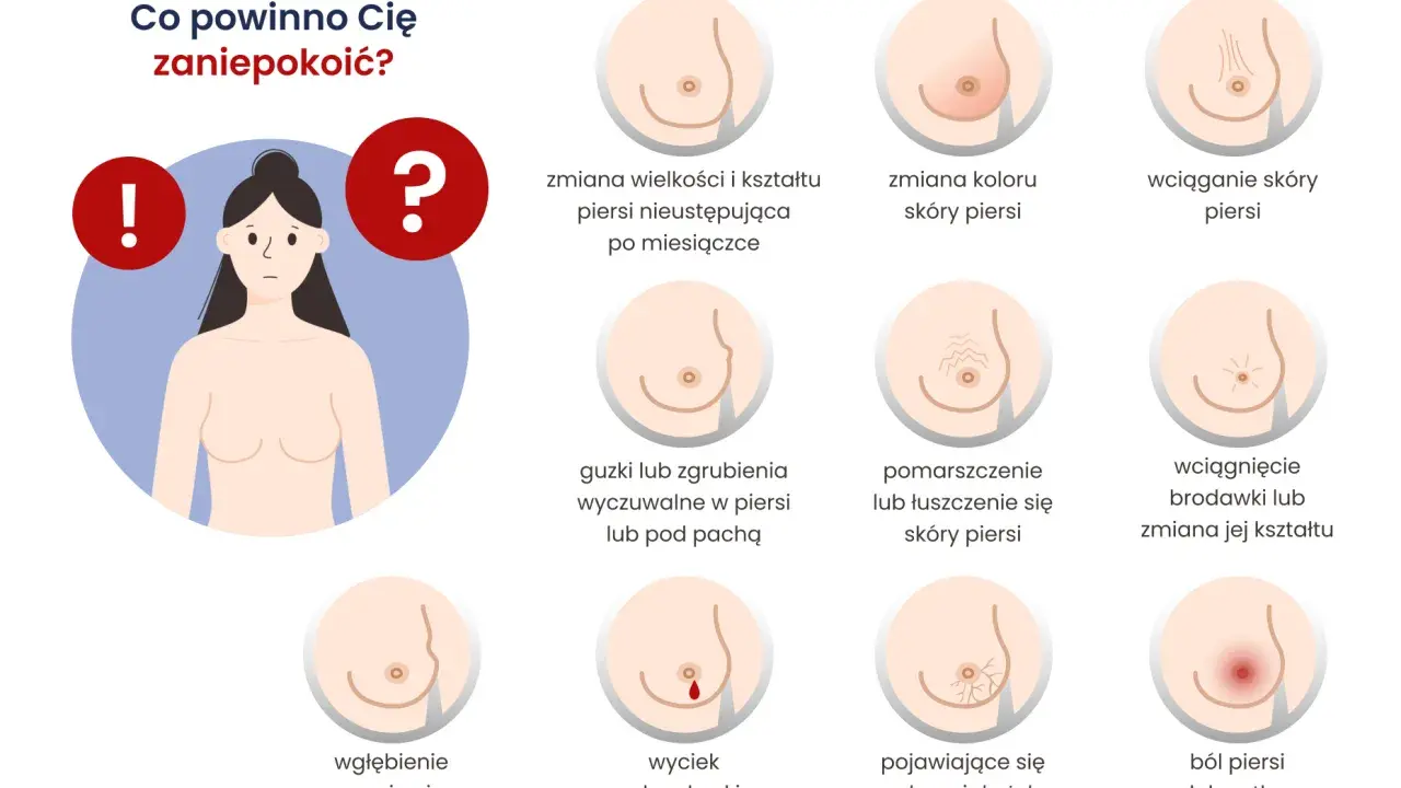 Grafika pokazuje objawy zaawansowanego raka piersi: zmiany skórne, guzki, wciągnięcie brodawki, wyciek, ból.