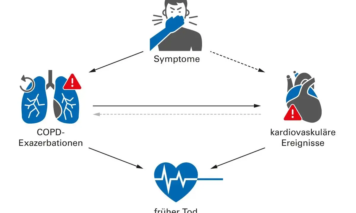 Diagramm zeigt, wie COPD-Exazerbationen zu Symptomen, kardiovaskulären Ereignissen und frühem Tod führen können.