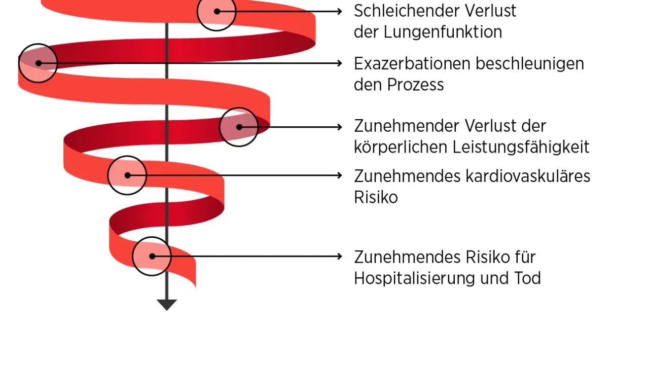 Abwärtsspirale bei COPD: schleichender Lungenfunktionsverlust, Exazerbationen, körperliche Leistungseinbußen, kardiovaskuläres Risiko, Hospitalisierung. Gewichtsverlust ist ein Zeichen des Endstadiums.