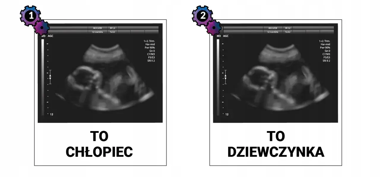 Jak rozpoznać płeć dziecka na USG? Kiedy i na co patrzy lekarz?