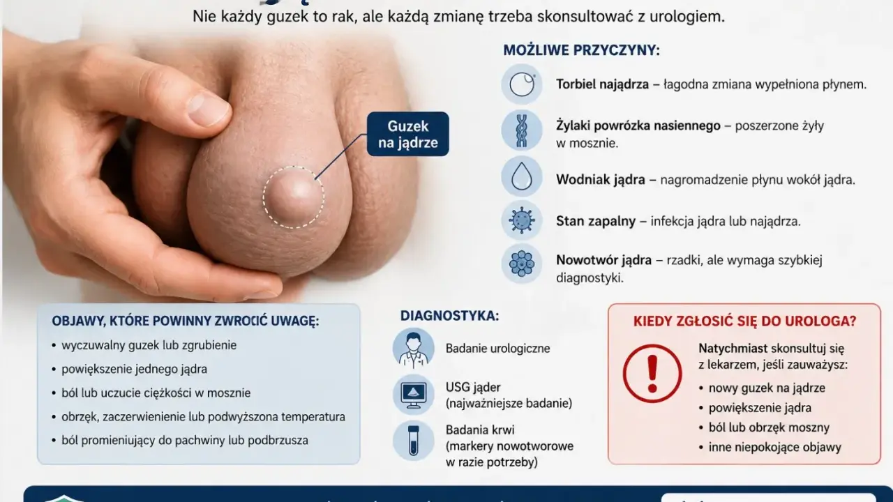 Powiększone i twarde jądro z wyczuwalnym guzem. Obraz przedstawia powiększone jądro z widocznym guzem, podkreślając potrzebę konsultacji urologicznej.