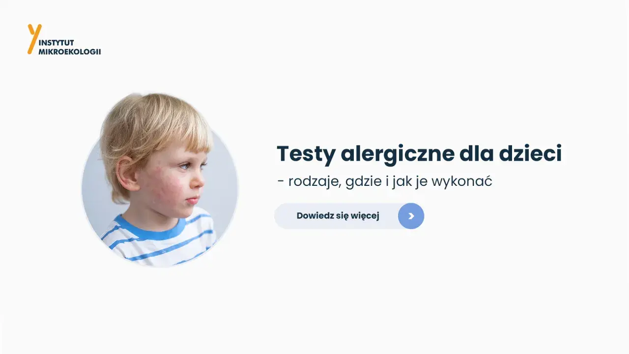 Chłopiec z zaczerwienioną skórą na twarzy. Informacja o testach alergicznych u dzieci.