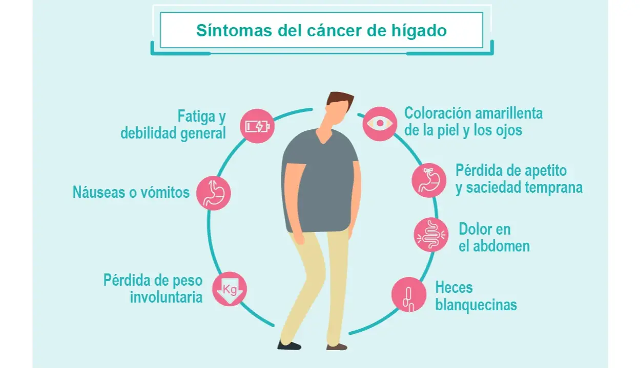 ¿Cáncer de hígado? Conoce sus síntomas y actúa a tiempo