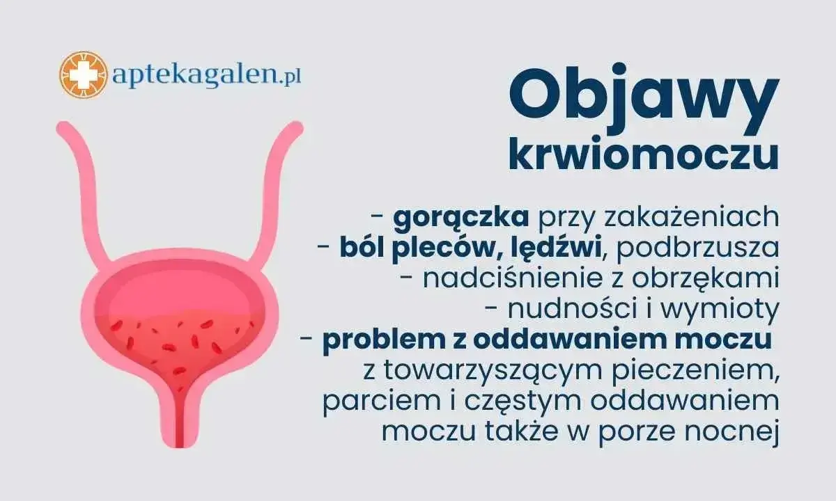 Objawy krwiomoczu: gorączka, ból pleców, nadciśnienie, nudności, wymioty, problem z oddawaniem moczu. Uszkodzenie cewki moczowej objawy mogą być podobne.