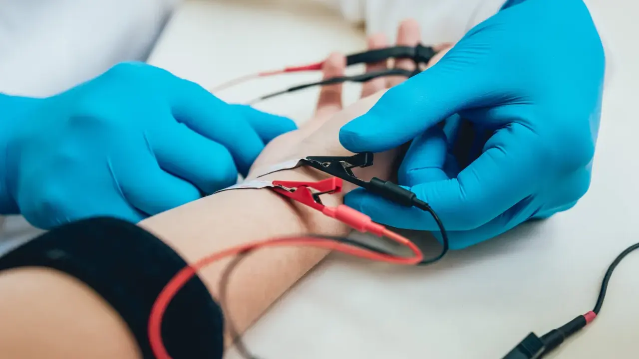 Badanie EMG, czyli elektromiografia, to badanie oceniające funkcję nerwów i mięśni. Na zdjęciu widać elektrody podłączone do ręki pacjenta.