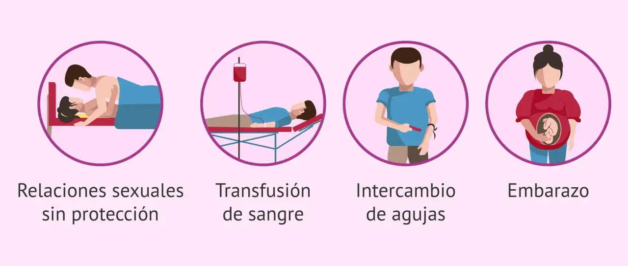 Ilustraciones muestran cómo se puede dar el contagio de clamidia: relaciones sexuales sin protección, transfusión de sangre, intercambio de agujas y embarazo.