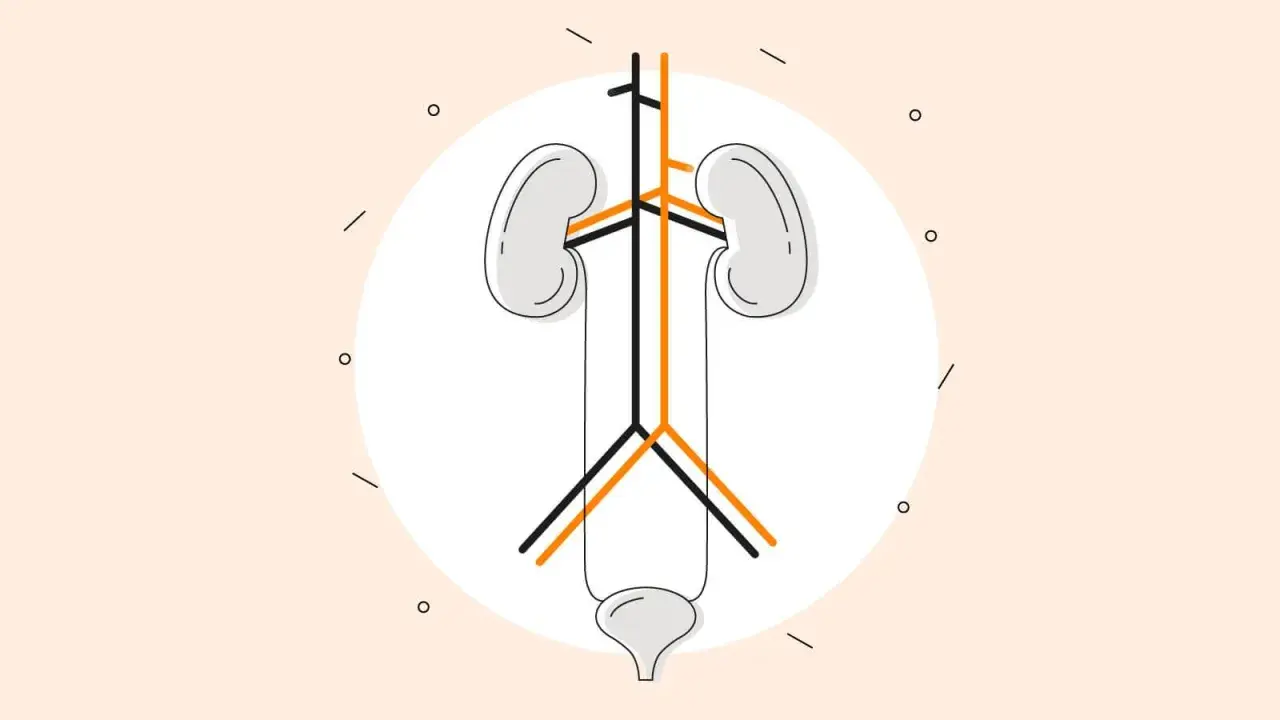 Ilustracja układu moczowego z naczyniami, symbolizująca powikłania dializy otrzewnowej.