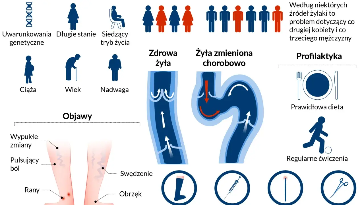 Jak dbać o żyły? Infografika przedstawia czynniki ryzyka żylaków, objawy, zdrową i chorą żyłę, a także profilaktykę: dietę, ćwiczenia, wyroby kompresyjne i metody leczenia.