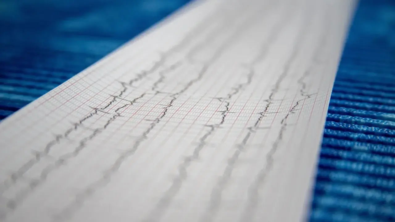 Wynik badania EKG, zapis fal na papierze milimetrowym.