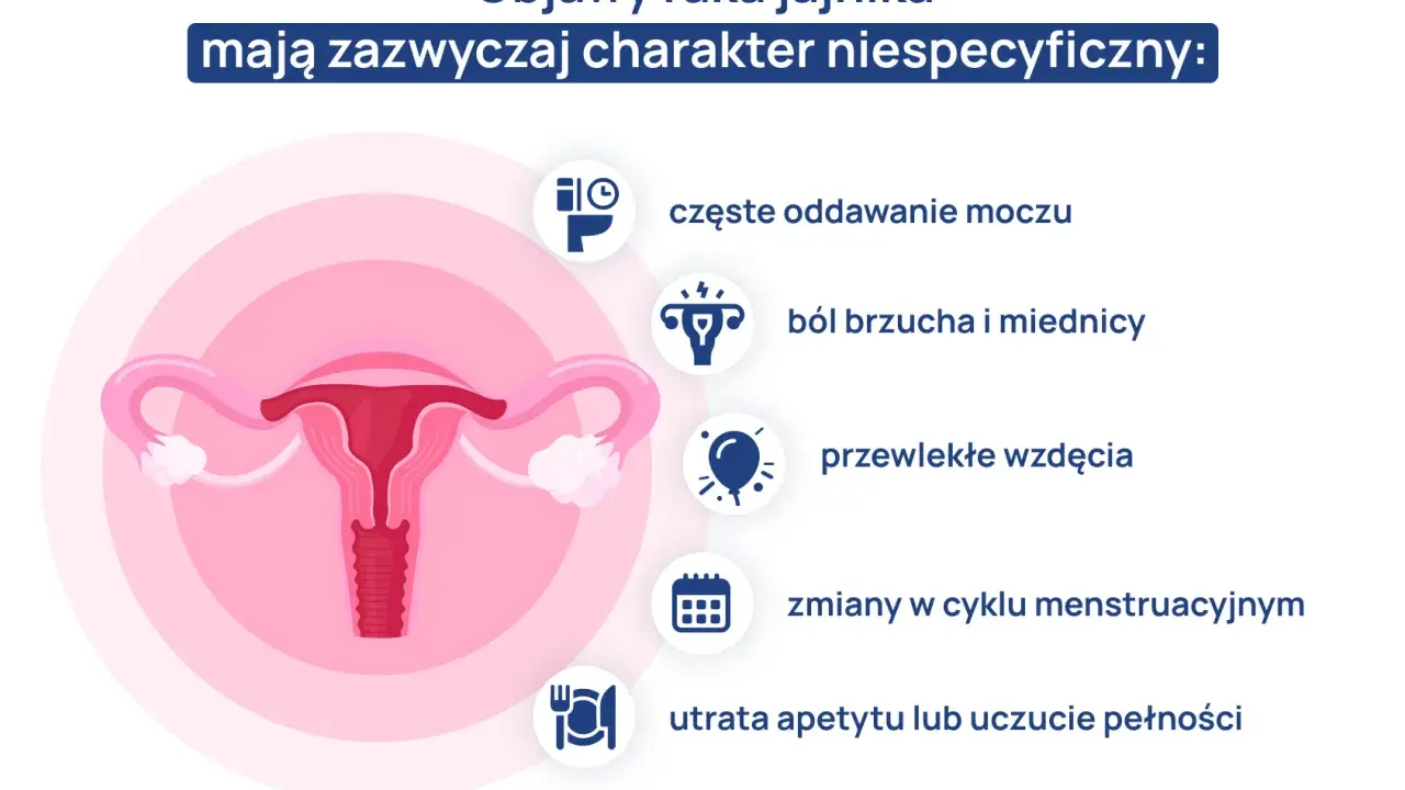 Ilustracja przedstawia narządy rodne kobiety z ikonami symbolizującymi objawy raka jajnika.