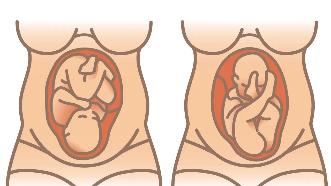Zwei Darstellungen eines schwangeren Bauches. Links liegt das Baby mit dem Kopf nach unten, rechts mit dem Kopf nach oben. Wie oft dreht sich das Baby im Bauch am Tag?