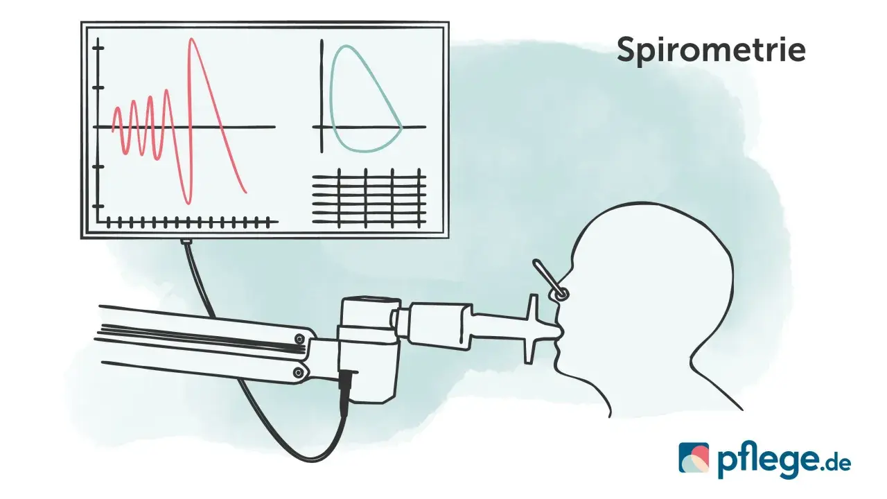 Spirometrie-Diagramm zeigt Lungenfunktion. Wichtig für COPD Gold 3 Rente.