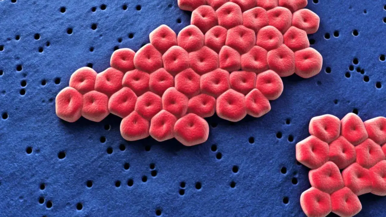 Acinetobacter baumannii, batterio resistente, si guarisce. Globuli rossi rossi su sfondo blu con piccoli fori.