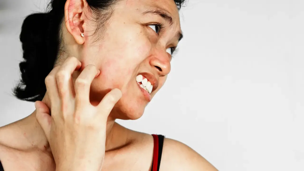 Une femme se gratte le cou et le visage, visiblement gênée par une peau très sèche et des démangeaisons.