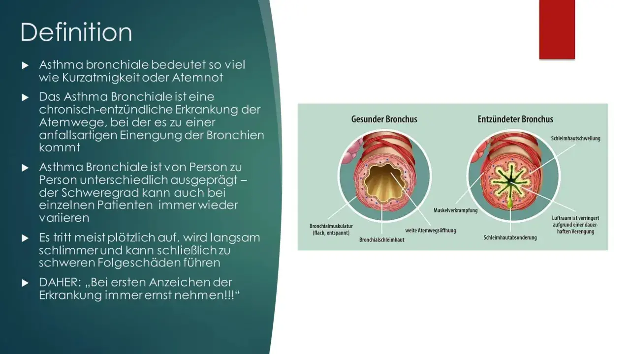 Vergleich gesunder und entzündeter Bronchien. Bei Asthma kommt es zu Muskelverkrampfungen und Schwellungen, die die Atemwege verengen.