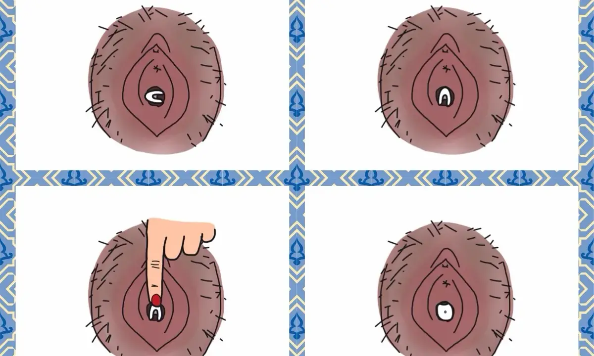 Illustration visar hur en menskopp vecklar ut sig. En hand trycker på den för att hjälpa den att veckla ut sig.