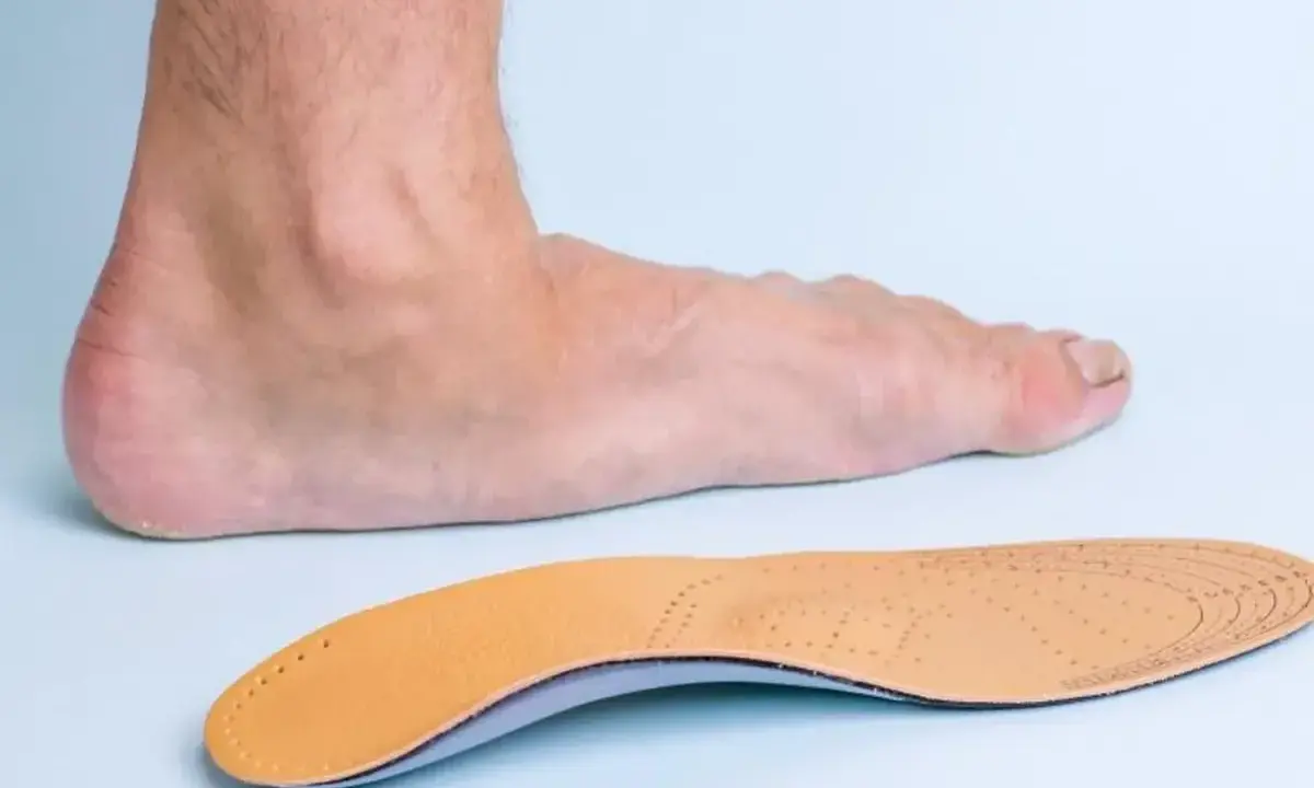 Un pied humain et une semelle orthopédique, conçue pour soulager les douleurs liées aux durillons et aux problèmes de voûte plantaire.