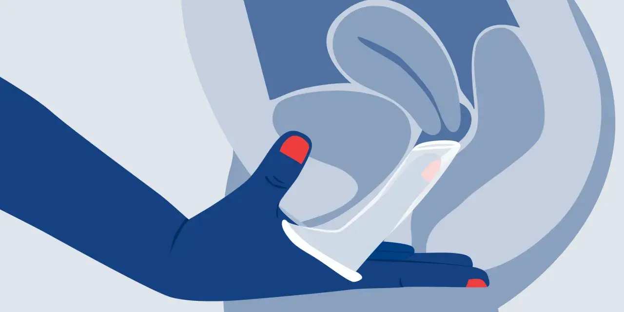 Ilustración de mano insertando un condón femenino. Explora los diversos tipos de condones femeninos para una protección segura.