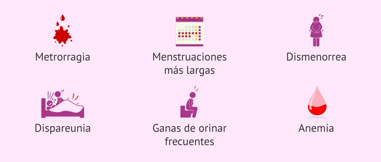 Síntomas como metrorragia, dismenorrea o dispareunia pueden indicar qué es un mioma.