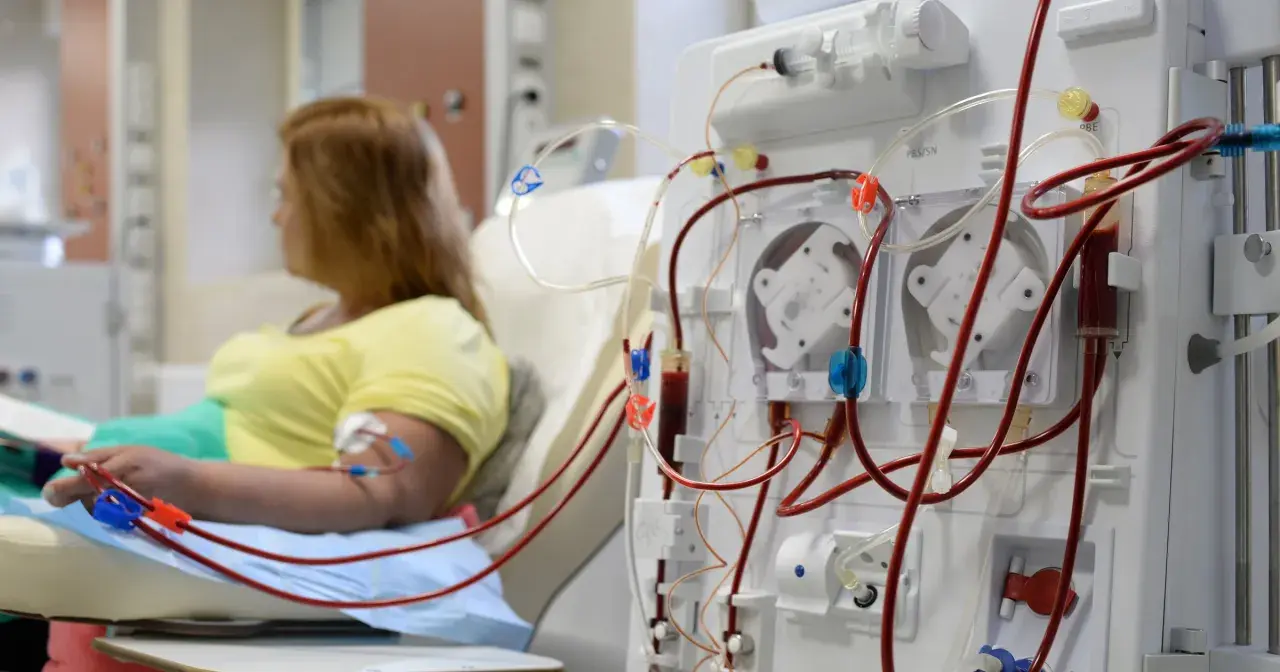 Kobieta podłączona do dializatora, który jest kluczowym elementem w leczeniu niewydolności nerek.