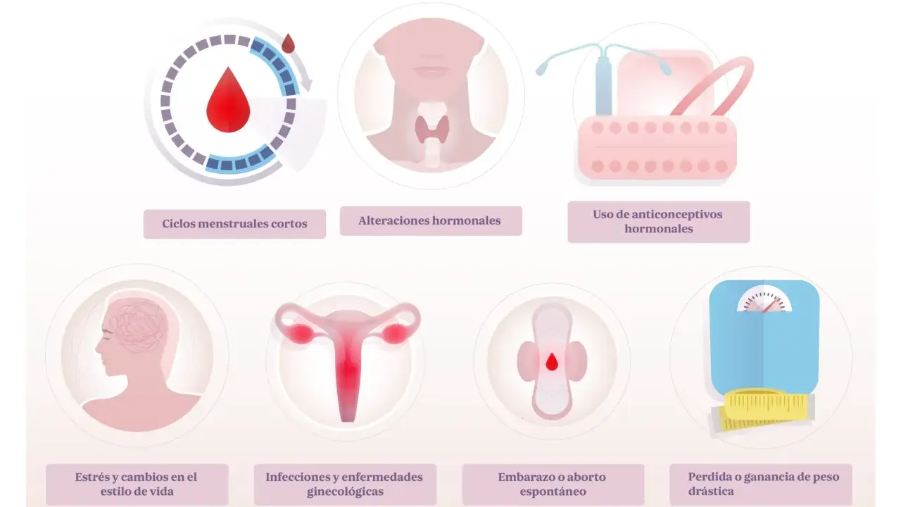 Ilustración muestra posibles causas de la regla cada 15 días: ciclos cortos, alteraciones hormonales, anticonceptivos, estrés, infecciones, embarazo o cambios de peso.