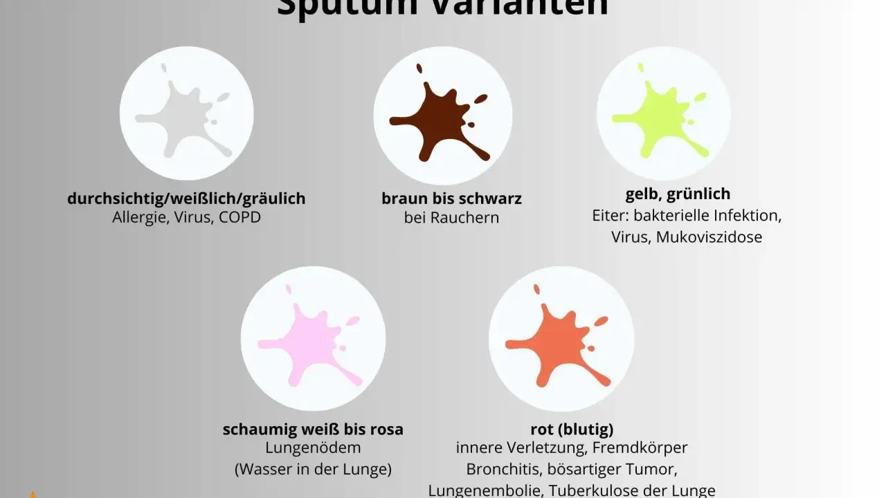 Sputum bei COPD kann durchsichtig/weißlich/gräulich sein. Andere Farben wie braun, gelb, grünlich, rosa oder blutig deuten auf andere Ursachen hin.