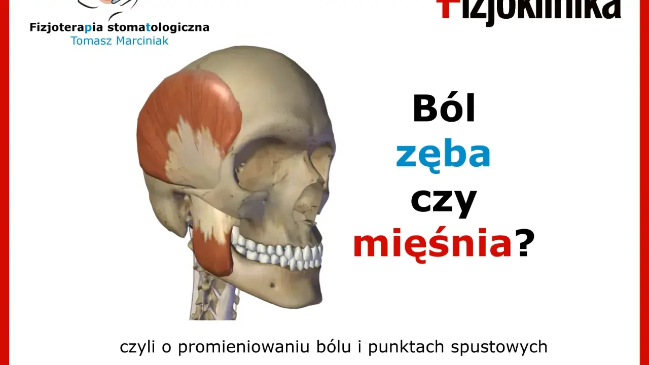 Model czaszki z zaznaczonym mięśniem skrzydłowym przyśrodkowym. Grafika pyta: "Ból zęba czy mięśnia?".