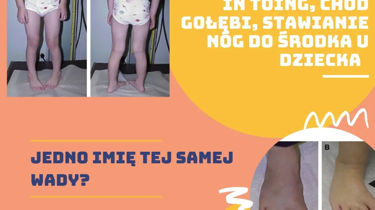 Dziecko z kaczym chodem, stawiające nogi do środka. Dwa zdjęcia pokazują tę samą wadę u dziecka.