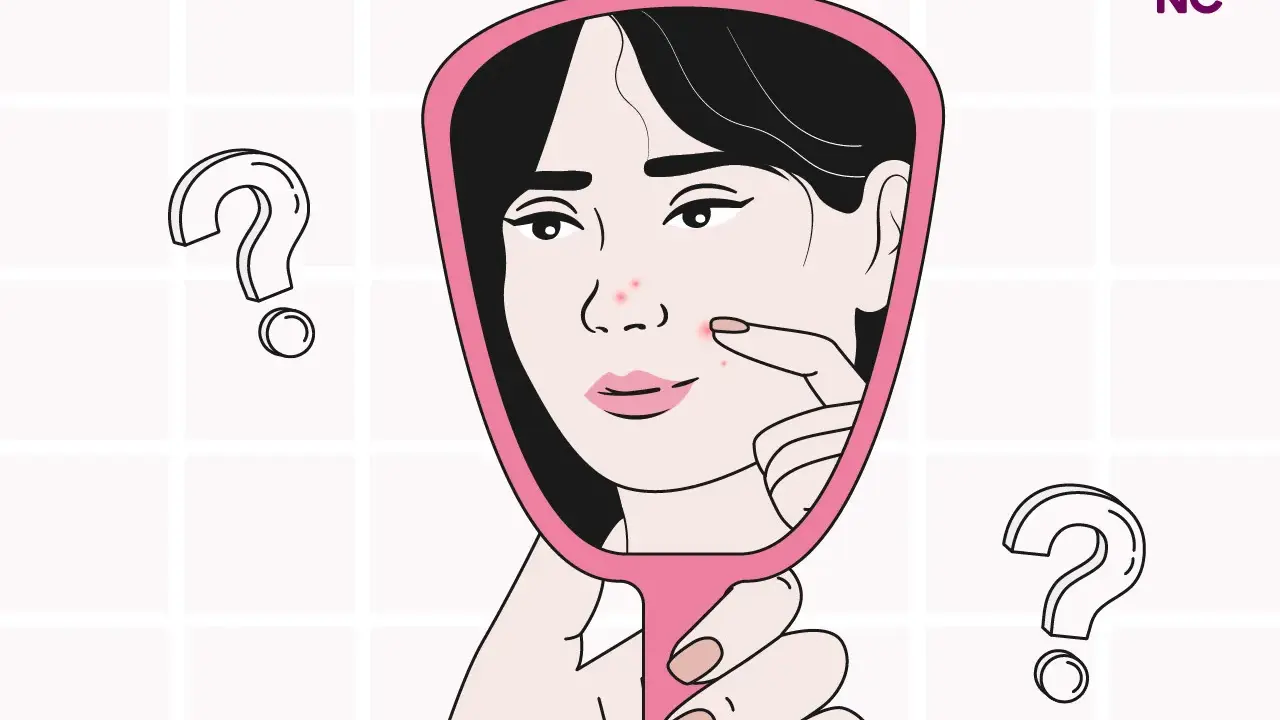 Una mujer se mira en un espejo, examinando granos en su rostro. ¿Será esto un sangrado por deprivación?