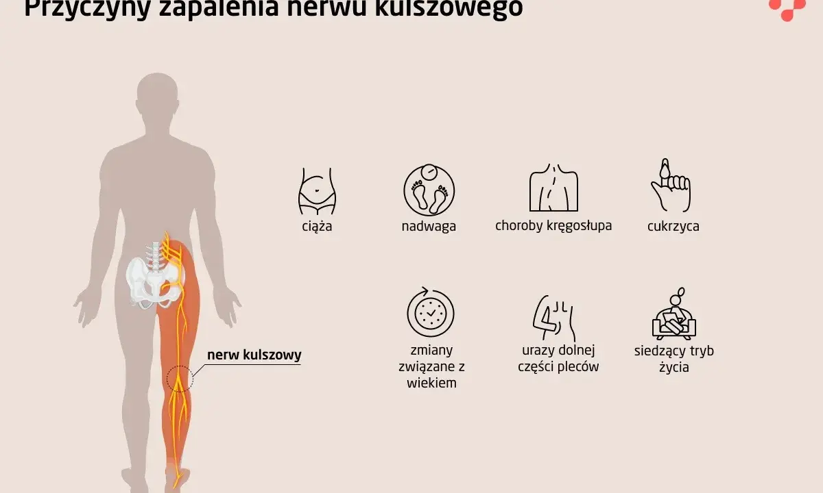 Ból i opuchlizna po przewianiu? To może być zapalenie nerwu!