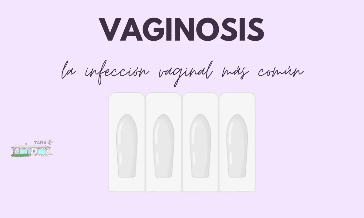 Vaginosis: la infección vaginal más común. Cuatro óvulos en su empaque, listos para tratar.