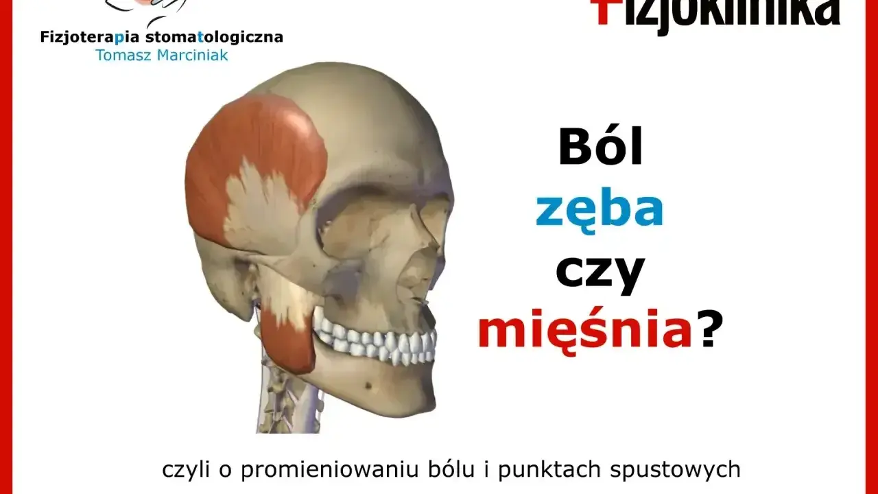Anatomia czaszki z zaznaczonymi mięśniami. Czy to ból zęba czy mięśnia? Fizjoterapia stomatologiczna.