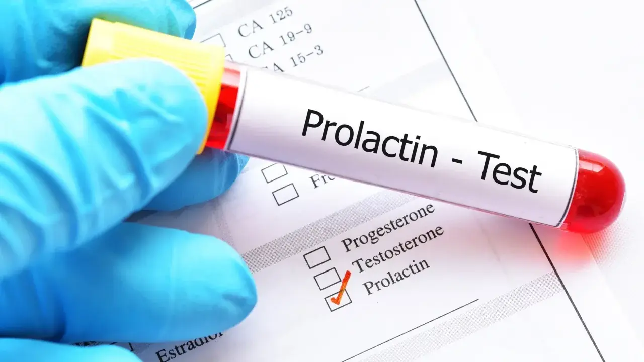 Hiperprolaktynemia: objawy, diagnostyka i jak obniżyć prolaktynę?