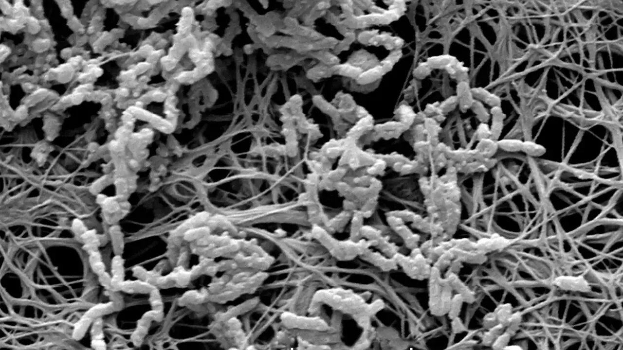 Achromobacter xylosoxidans, batteri filamentosi che colonizzano una matrice extracellulare fibrosa.