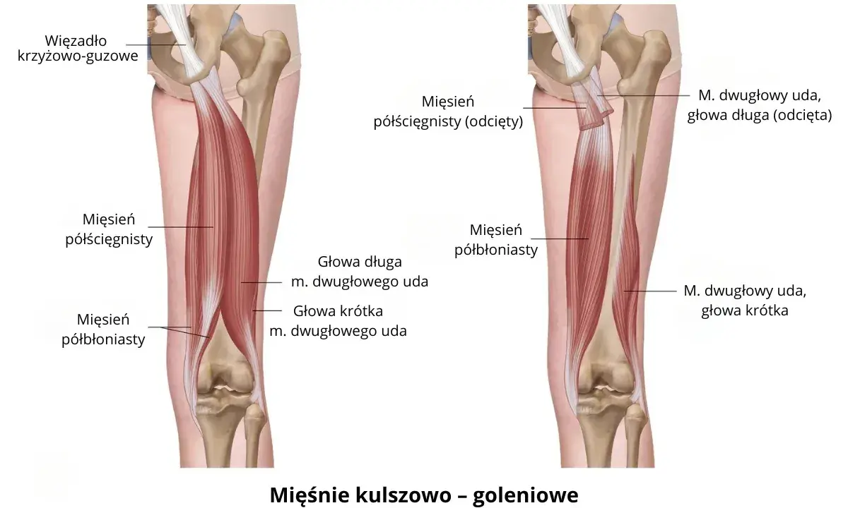 Anatomia mięśni kulszowo-goleniowych: mięsień półścięgnisty i półbłoniasty, głowy mięśnia dwugłowego uda.
