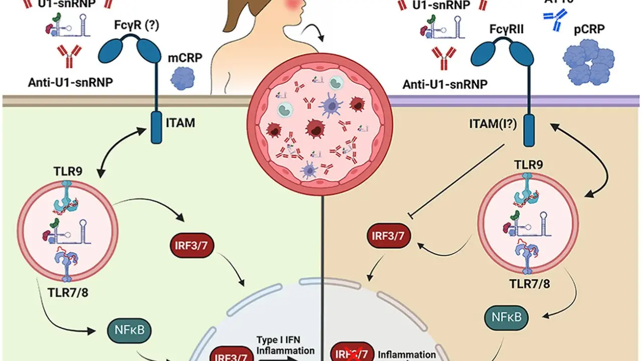 Schema illustra meccanismi infiammatori mediati da anticorpi anti-U1-snRNP e proteina C reattiva (pCRP).
