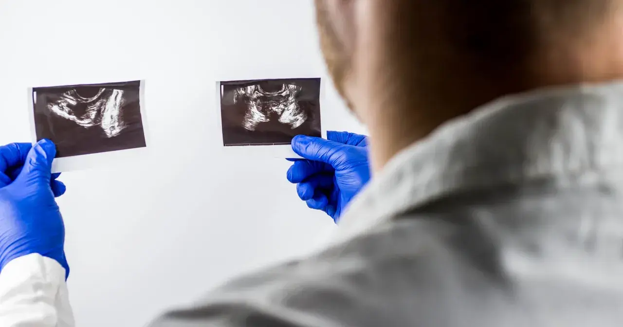 Lekarz w niebieskich rękawiczkach analizuje dwa zdjęcia USG, szukając odpowiedzi na pytanie: rak prostaty ile się żyje.