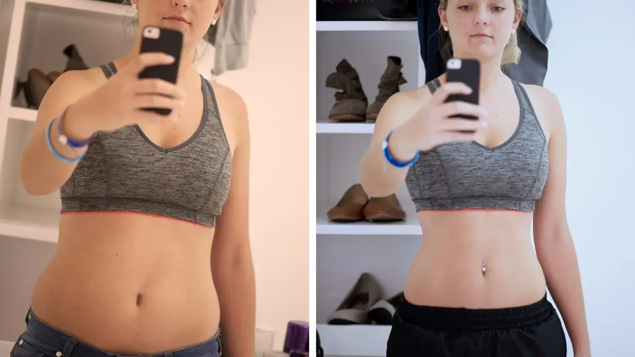 Kobieta w sportowym topie robi sobie selfie, pokazując brzuch przed i po zabiegu.
