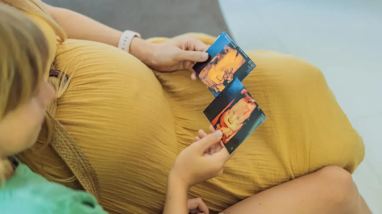 Dziecko na zdjęciach usg 3d, które trzymają mama i starsze rodzeństwo.