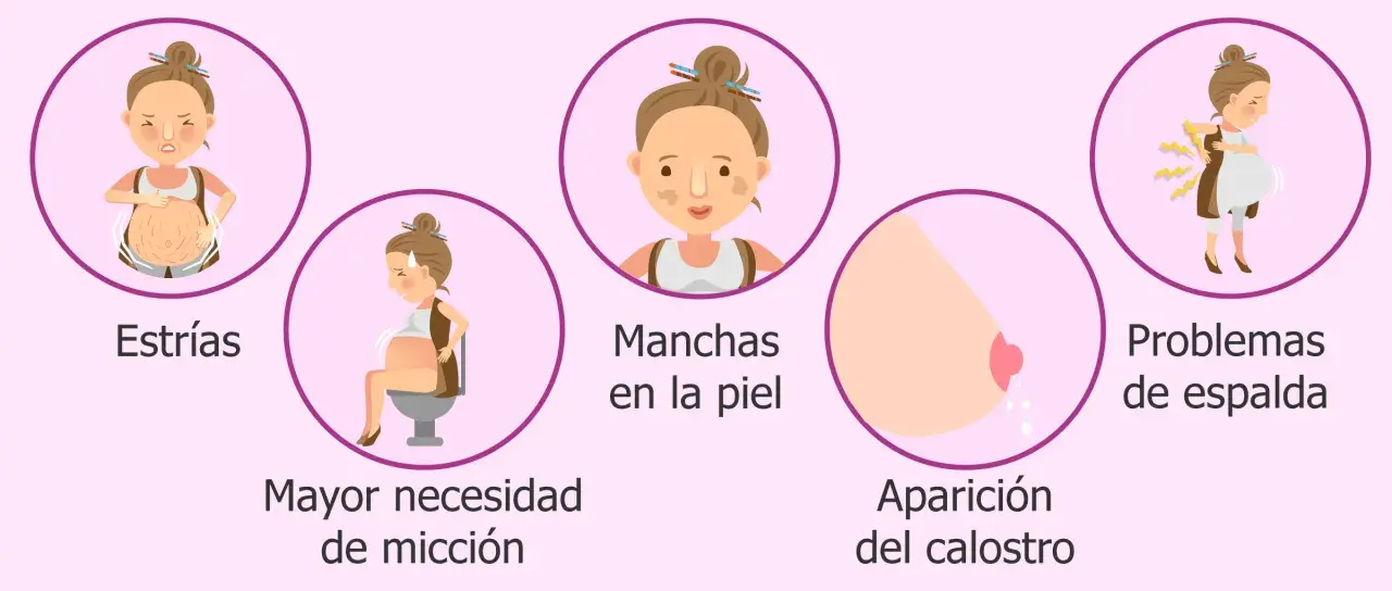 Ilustración de síntomas de embarazo: estrías, mayor necesidad de micción, manchas en la piel, aparición del calostro y problemas de espalda.