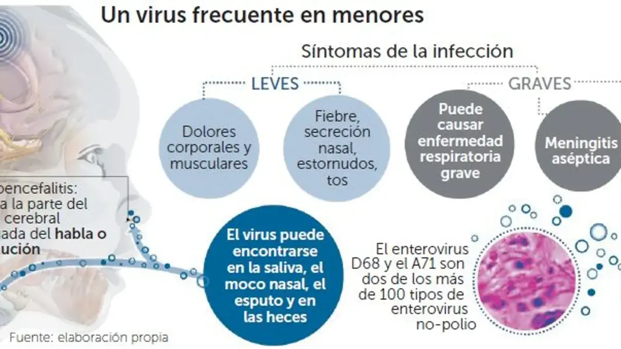 Infografía sobre enterovirus en niños, detallando síntomas leves y graves, dónde se encuentra el virus y tipos específicos como D68 y A71.