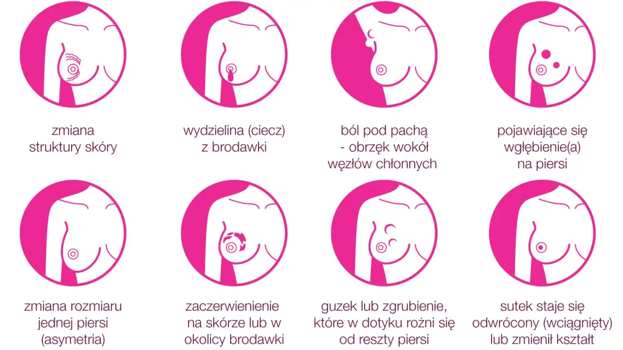 Grafika pokazuje objawy raka piersi: guzek, zmiany skórne, wydzielinę z brodawki, ból, wgłębienia, asymetrię, zaczerwienienie i odwrócony sutek.