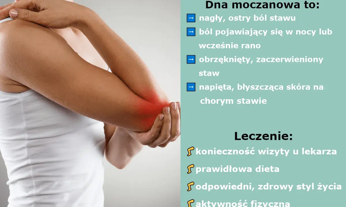 Dna moczanowa: nagły ból stawu, obrzęk, zaczerwienienie i napięta skóra. Leczenie: wizyta u lekarza, dieta, zdrowy styl życia, aktywność fizyczna.