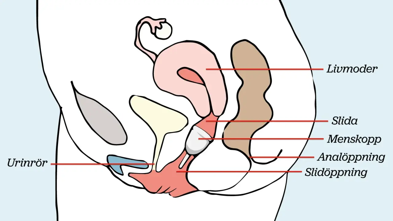 Illustration visar hur en menskopp placeras i slidan för att samla upp mensblod.