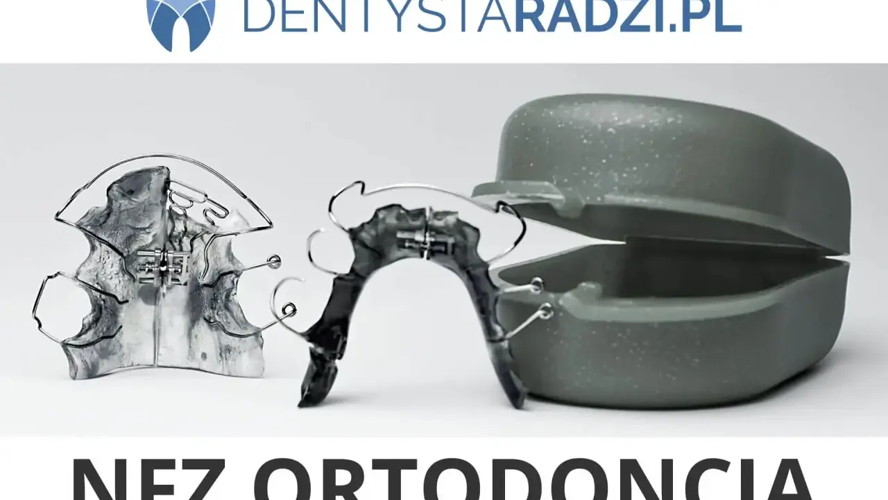 Aparat na zęby z NFZ? Tylko dla wybranych. Sprawdź, czy się łapiesz!