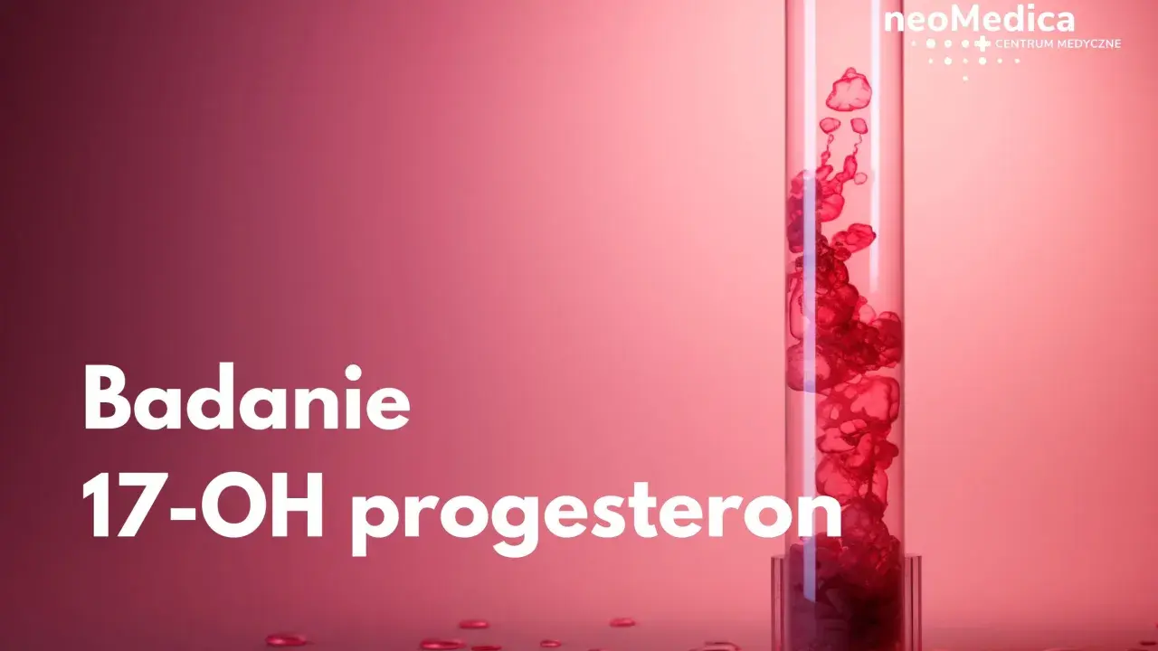 Badanie 17-OH progesteron. Podwyższony poziom może wiązać się z objawami takimi jak trądzik czy nadmierne owłosienie.