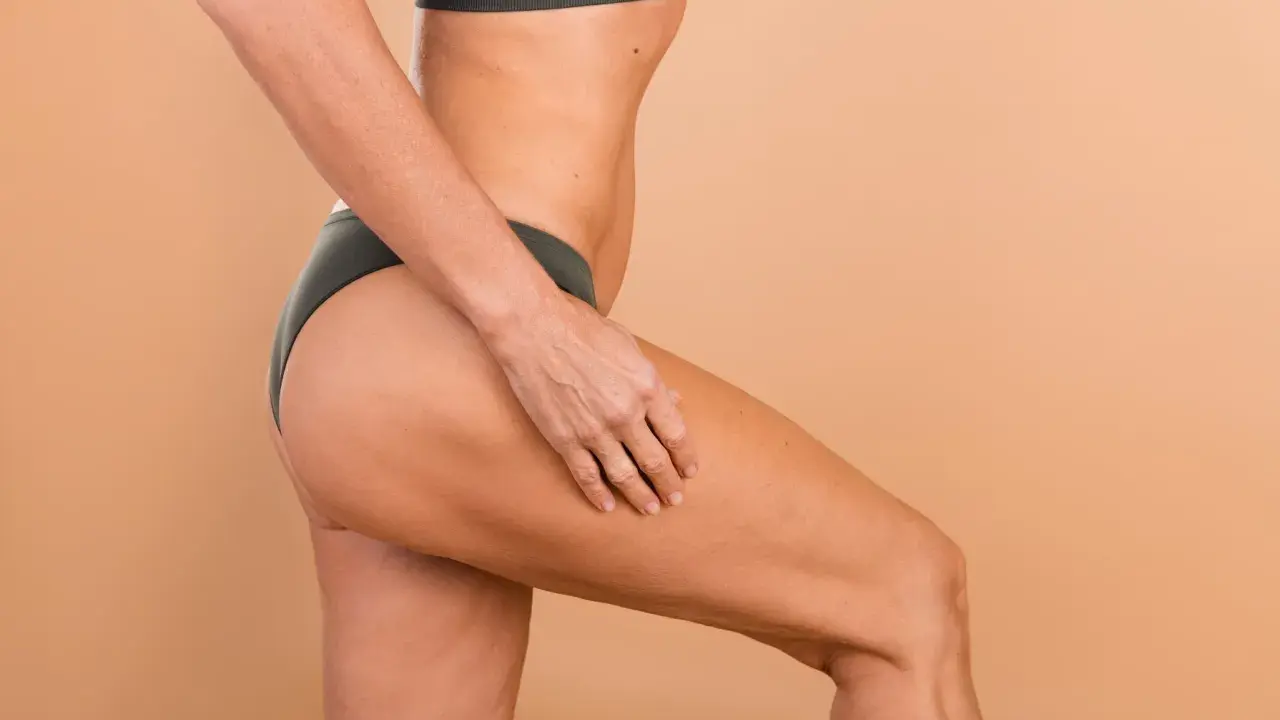 Une femme touche sa cuisse, montrant la peau et les effets de la cellulite. Des solutions pour enlever cellulite cuisse existent.