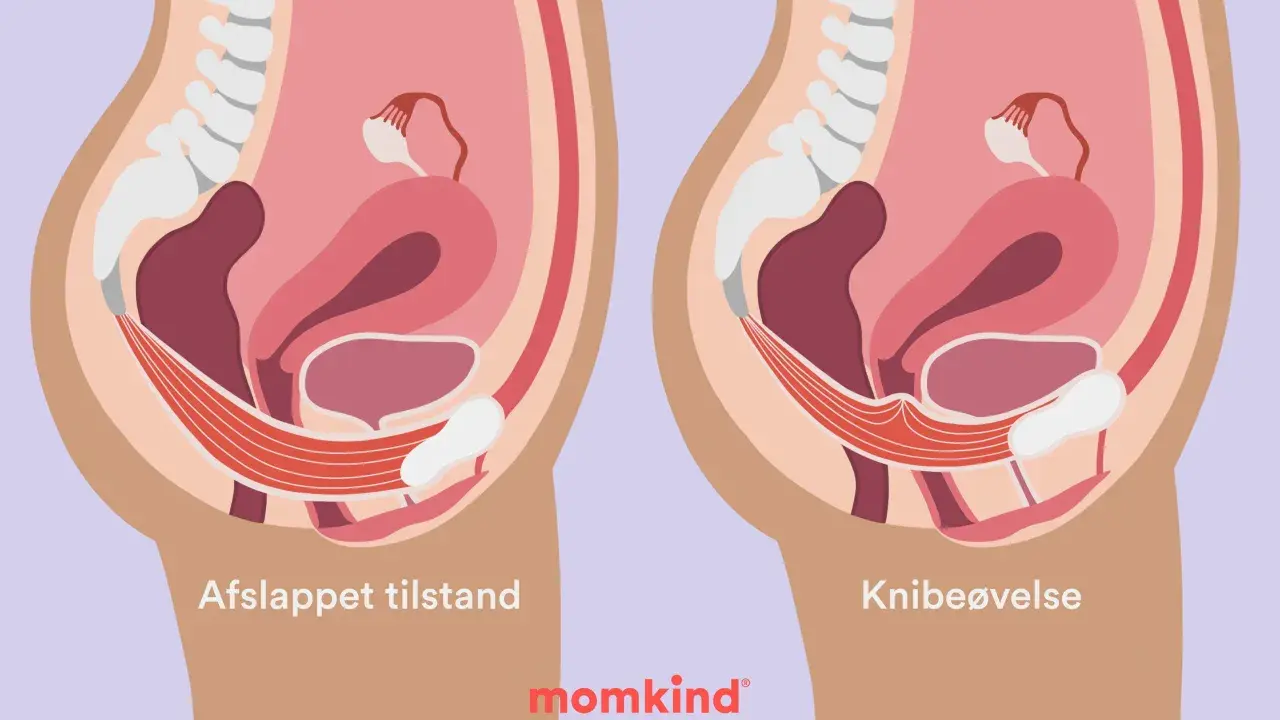 Illustration visar bäckenbottenmuskulaturen i avslappnat och kontraherat läge. Knipövningar är en del av symfysit behandling.
