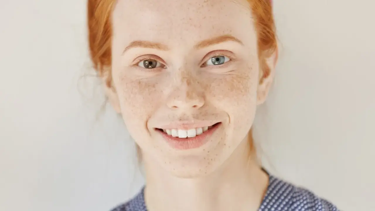 Ruda dziewczyna z piegami i różnymi kolorami oczu – przykład heterochromii.